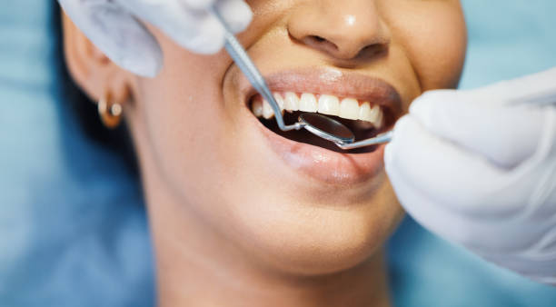 Best Emergency Wisdom Tooth Extraction in Oral City, FL